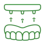 all on 4 dental implants