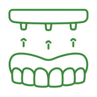 all on 4 dental implants