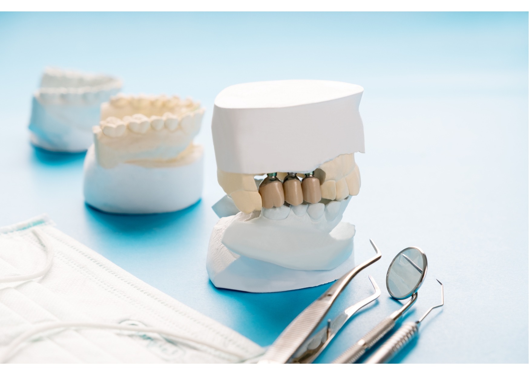 Dental implant bridge model and instruments used to explain the cost of dental implants and restoration options