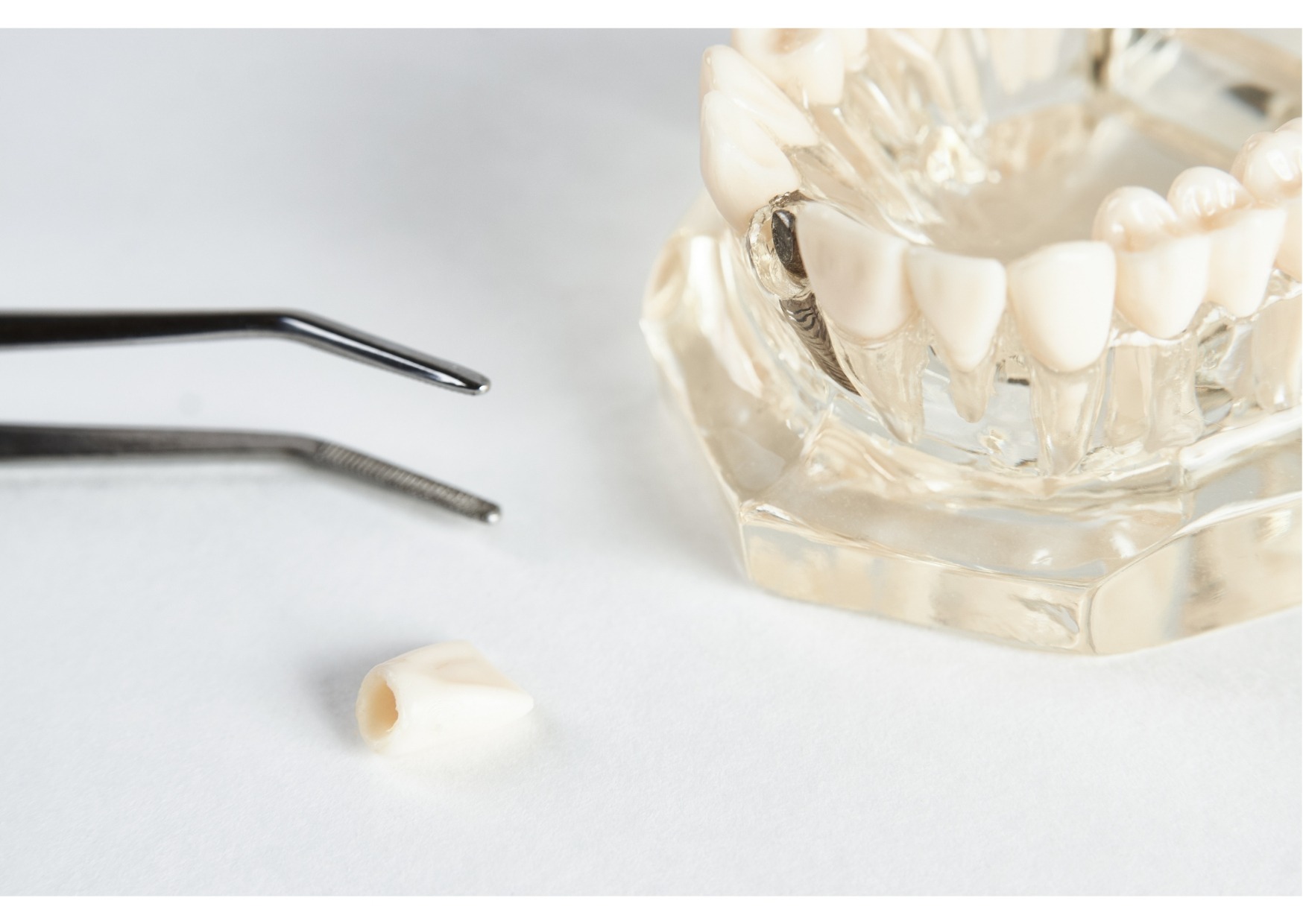 Dental implant model with replacement crown and tools used for implant-supported tooth restoration