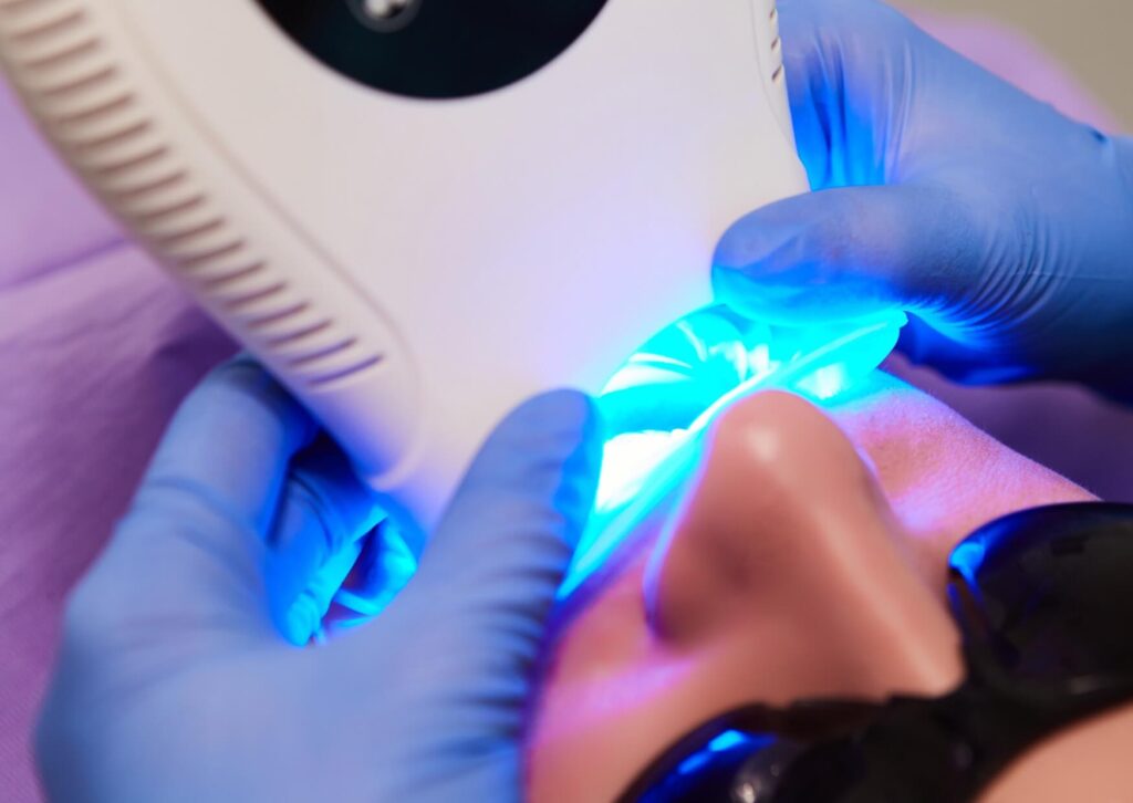 Dentist applying professional teeth whitening treatment, illustrating how teeth whitening strips compare in effectiveness.