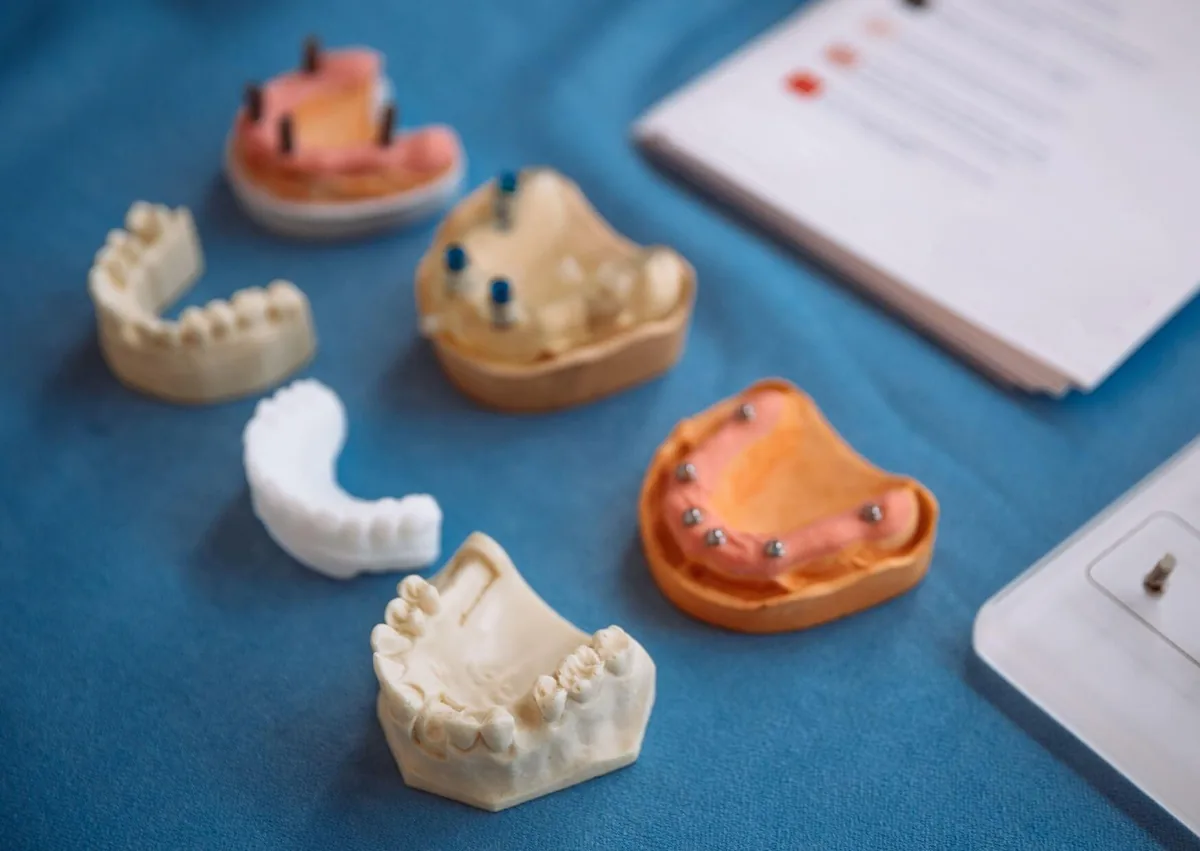 Dental implant and full-arch restoration models used to explain full mouth dental implants cost and treatment choices.