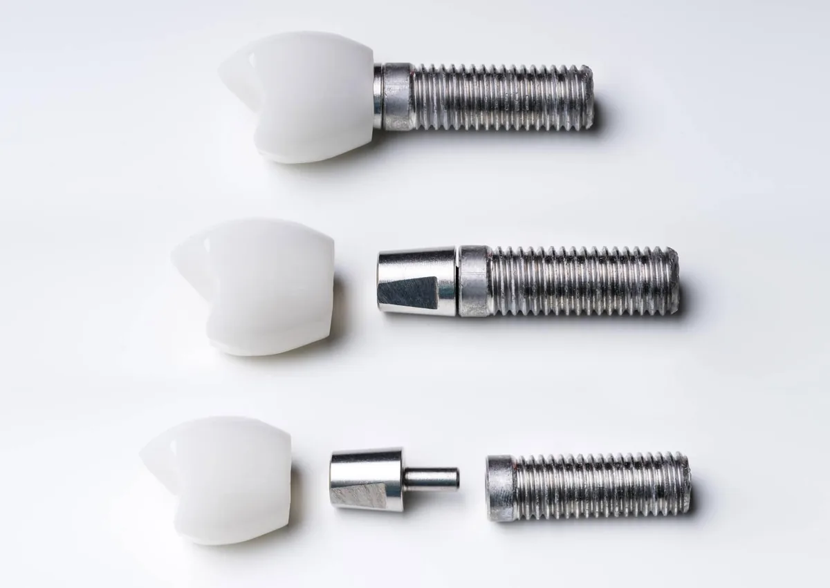 Dental implant components showing titanium posts, abutments, and crowns that contribute to the overall cost of a single tooth implant.